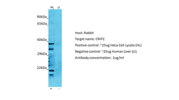 CRIP2 Rabbit Polyclonal Antibody