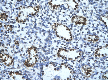 ENO1 Rabbit Polyclonal Antibody