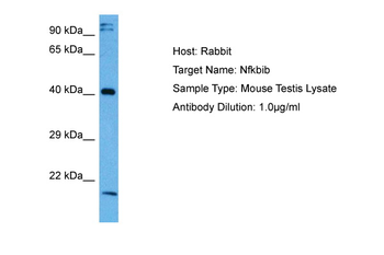 NFKBIB Rabbit Polyclonal Antibody