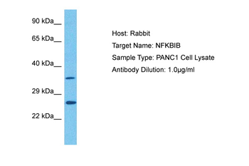NFKBIB Rabbit Polyclonal Antibody