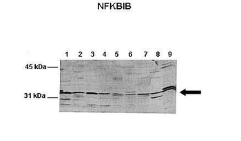 NFKBIB Rabbit Polyclonal Antibody