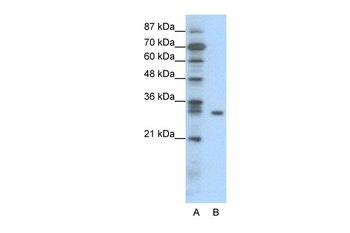 NFKBIB Rabbit Polyclonal Antibody