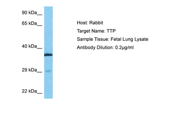 ZFP36 Rabbit Polyclonal Antibody
