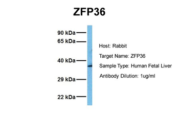 ZFP36 Rabbit Polyclonal Antibody