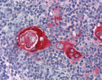 ZFP36 Rabbit Polyclonal Antibody