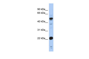 CSRP1 Rabbit Polyclonal Antibody