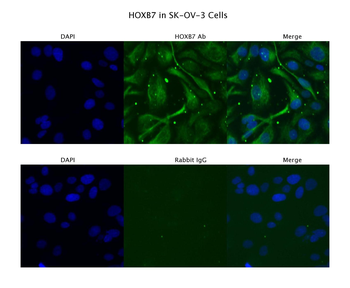 HOXB7 Rabbit Polyclonal Antibody