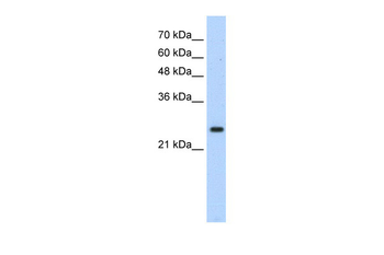 HOXB7 Rabbit Polyclonal Antibody