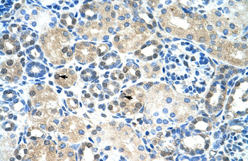 IER2 Rabbit Polyclonal Antibody