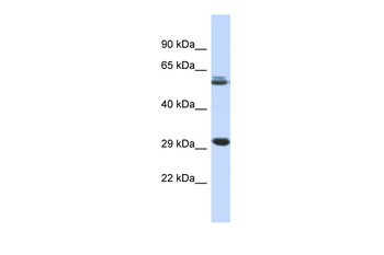 PCGF3 Rabbit Polyclonal Antibody