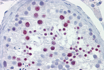 BRD3 Rabbit Polyclonal Antibody