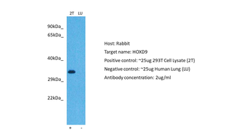 HOXD9 Rabbit Polyclonal Antibody