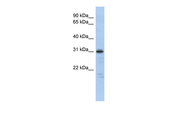 HOXD9 Rabbit Polyclonal Antibody
