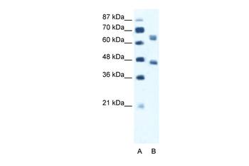 RRN3 Rabbit Polyclonal Antibody