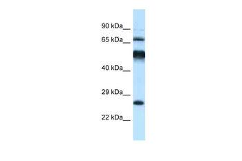 Klhl1 Rabbit Polyclonal Antibody