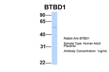 BTBD1 Rabbit Polyclonal Antibody