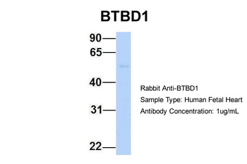 BTBD1 Rabbit Polyclonal Antibody