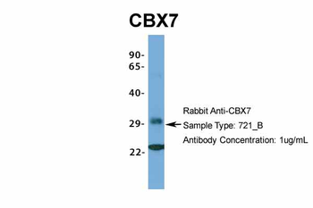CBX7 Rabbit Polyclonal Antibody