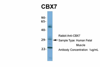 CBX7 Rabbit Polyclonal Antibody