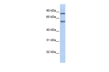 TRIM50 Rabbit Polyclonal Antibody