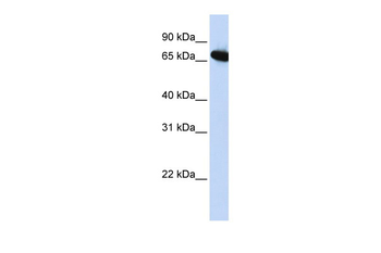 DLX4 Rabbit Polyclonal Antibody