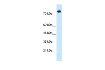 ZMYM3 Rabbit Polyclonal Antibody