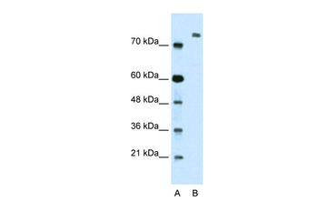 ZMYM3 Rabbit Polyclonal Antibody