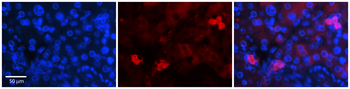 NRF1 Rabbit Polyclonal Antibody