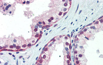 NRF1 Rabbit Polyclonal Antibody