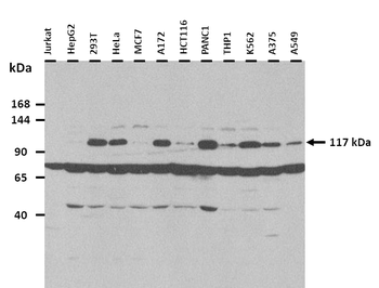 ZFR Rabbit Polyclonal Antibody