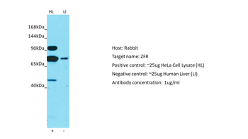 ZFR Rabbit Polyclonal Antibody