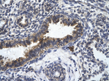 ZFR Rabbit Polyclonal Antibody