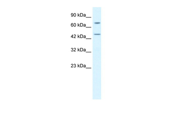 KLHL25 Rabbit Polyclonal Antibody