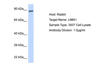 LIMA1 Rabbit Polyclonal Antibody
