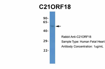 C21ORF18 Rabbit Polyclonal Antibody