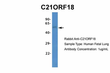 C21ORF18 Rabbit Polyclonal Antibody
