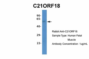 C21ORF18 Rabbit Polyclonal Antibody