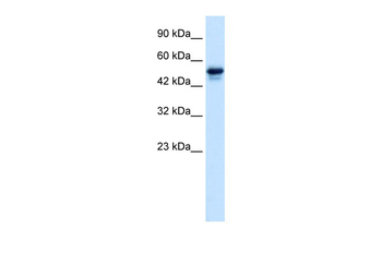 C21ORF18 Rabbit Polyclonal Antibody