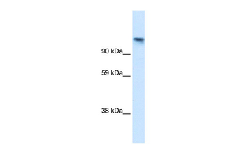 TIP120A Rabbit Polyclonal Antibody