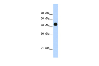 DMTF1 Rabbit Polyclonal Antibody