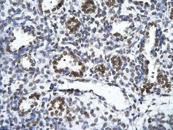 ZNF148 Rabbit Polyclonal Antibody