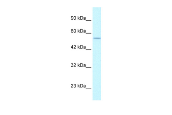 EGLN1 Rabbit Polyclonal Antibody