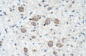KLHL25 Rabbit Polyclonal Antibody