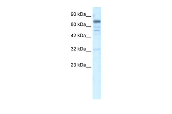 RIN3 Rabbit Polyclonal Antibody