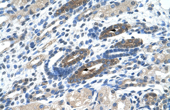 BTBD14A Rabbit Polyclonal Antibody