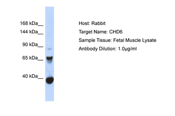 CHD6 Rabbit Polyclonal Antibody