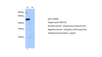 RNF135 Rabbit Polyclonal Antibody