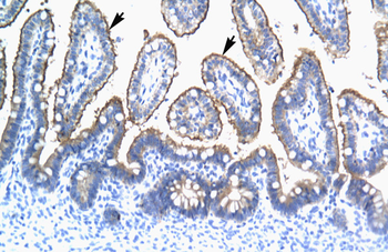 TRIM15 Rabbit Polyclonal Antibody