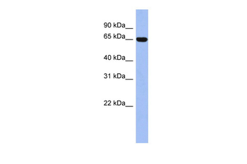 TRIM47 Rabbit Polyclonal Antibody