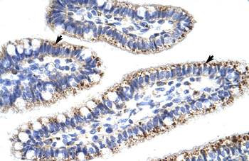 KLHL13 Rabbit Polyclonal Antibody